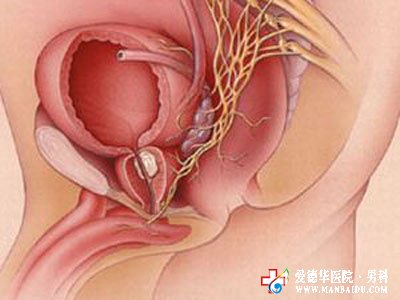男性前列腺增生怎么辦-九江醫(yī)大醫(yī)院