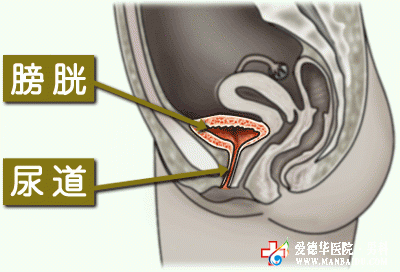 男性長期憋尿會引起膀胱炎嗎——九江醫大醫院
