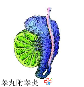 睪丸附睪炎一般都有哪些危害呢？九江醫(yī)大醫(yī)院