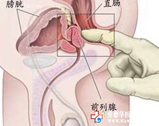 前列腺囊腫的危害甚多 九江醫(yī)大醫(yī)院