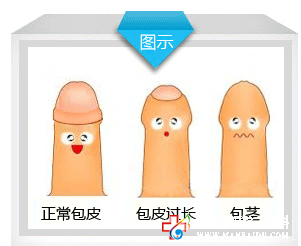包皮整形還你真“性福”！石河子五洲醫(yī)院
