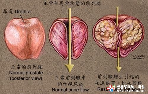 九江專治前列腺增生醫(yī)院—九江醫(yī)大醫(yī)院
