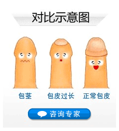 包皮過長(zhǎng)是否影響生育