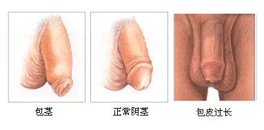 九江市哪家男科醫(yī)院比較好